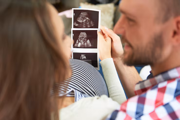 3D/4D Sonography